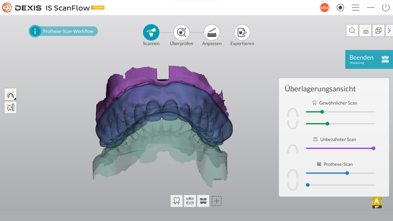 Überlagerungsansicht in DEXIS ScanFlow. © DEXIS