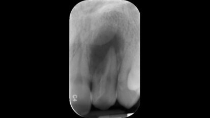 OMD promove curso de Controlo microbiológico em endodontia
