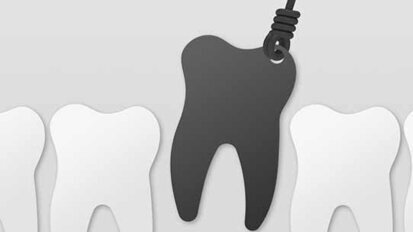 Warum wird in Deutschland so wenig implantiert? Warum wird in Deutschland so wenig implantiert?