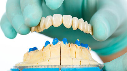 Coronavirus: Gefahr durch Zahnersatz aus China? Coronavirus: Gefahr durch Zahnersatz aus China?