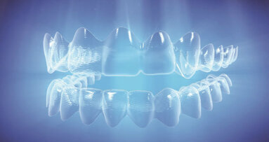 Invisalign, nuove funzioni SmartForce per supportare gli specialisti nel trattamento dei casi più complessi
