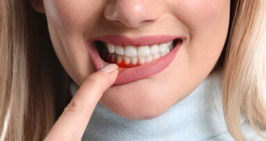 Parodontologija na korak bliže priznavanju u EU