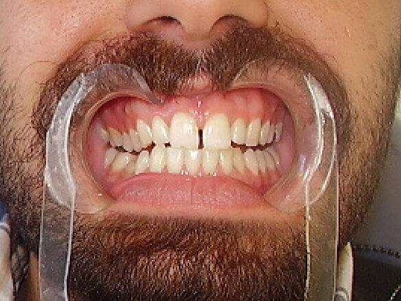 Figura 1. Situación inicial.