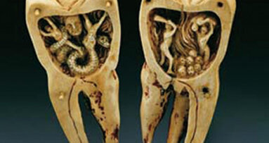 Historia de la Odontología. Capítulo II: La Odontología en las civilizaciones antíguas: Mesopotamia y Egipto