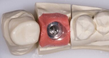 Dwuczęściowe łączniki – w przypadkach, kiedy ma to sens