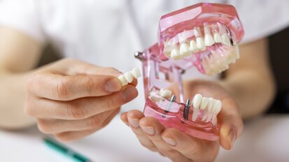Geistlich webinar to explore AI and precision approaches in implant dentistry
