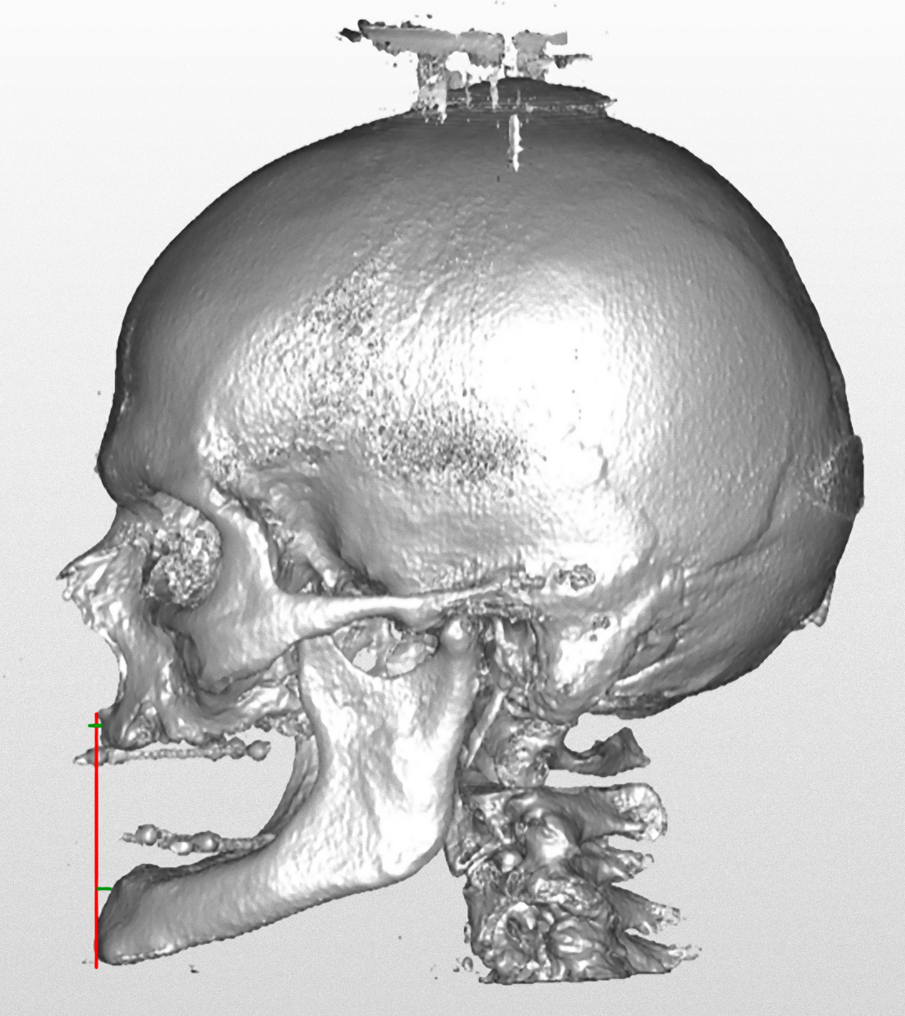 Fig. 9_Analisi sagittale.