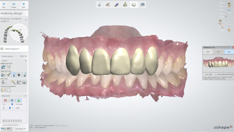 Dentsply Sirona and 3Shape expand their strategic partnership