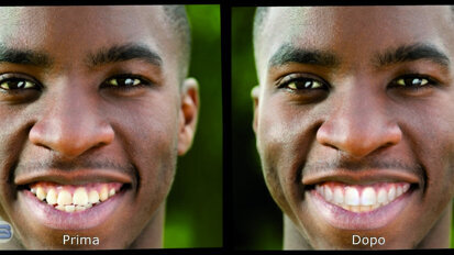 Projecting a new smile from a facial photograph: A new way to plan multidisciplinarydental treatments