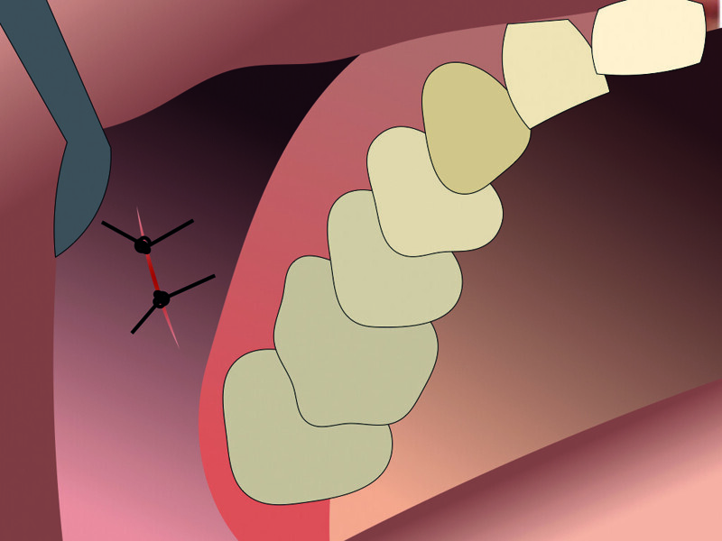 Fig. 14 : Site chirurgical suturé.