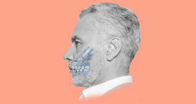 Advancing zygomatic implantology: Nobel Biocare’s Zygoma Academy drives clinical excellence