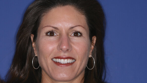 Facial esthetics treatment for every dental practice