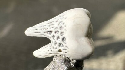 Implanty na miarę – idealnie dopasowane i pozwalające na wrastanie tkanki kostnej