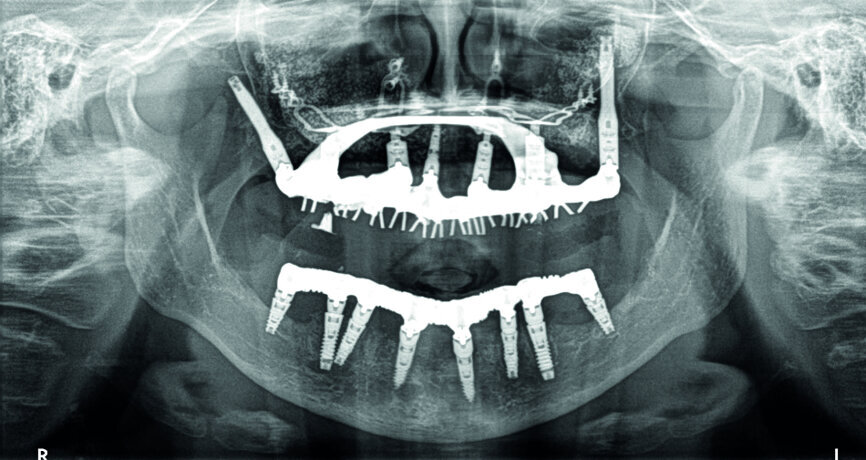 Cas 1f : Contrôle radiologique