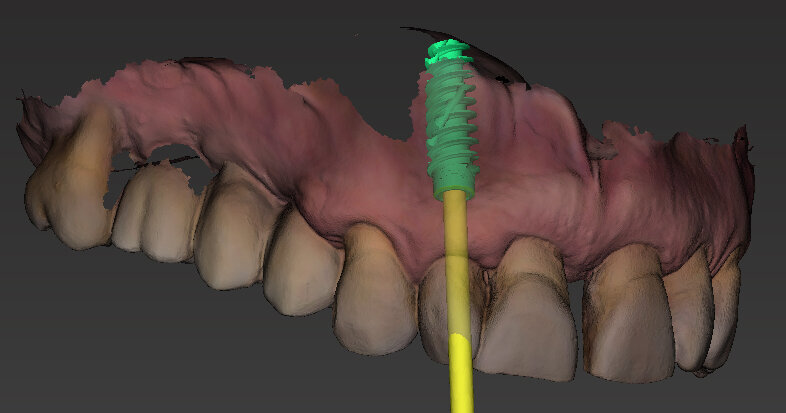 Fig. 10 - Posizionamento virtuale dell’impianto 1.2.