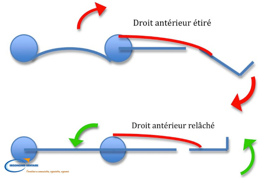 Fig 4 : La flexion des genoux crée une mise en tension des muscles droits antérieurs et une hyperlordose en position allongée. (Dr David Blanc)