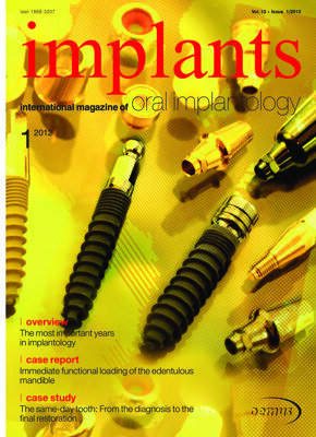 implants international No. 1, 2012 implants international No. 1, 2012