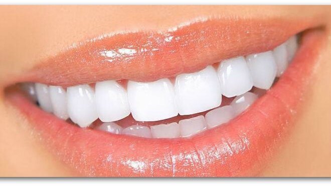 Θεραπευτική αντιμετώπιση της οδοντινικής υπερευαισθησίας