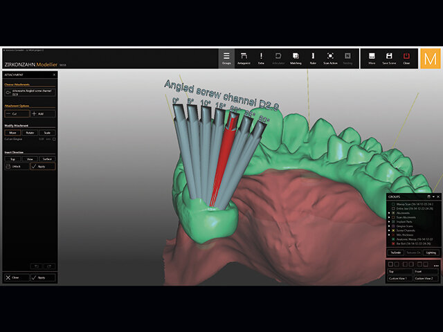 Kanál pro šroubek se pak uzpůsobí požadovanému sklonu.