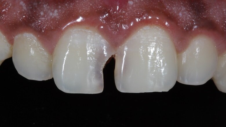 Fig 1: Pre-operative photograph