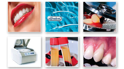 Workshop Silfradent: Concentrated Growth Factors (CGF) nella rigenerazione ossea e tessutale, aumenti di cresta orizzontali e verticali
