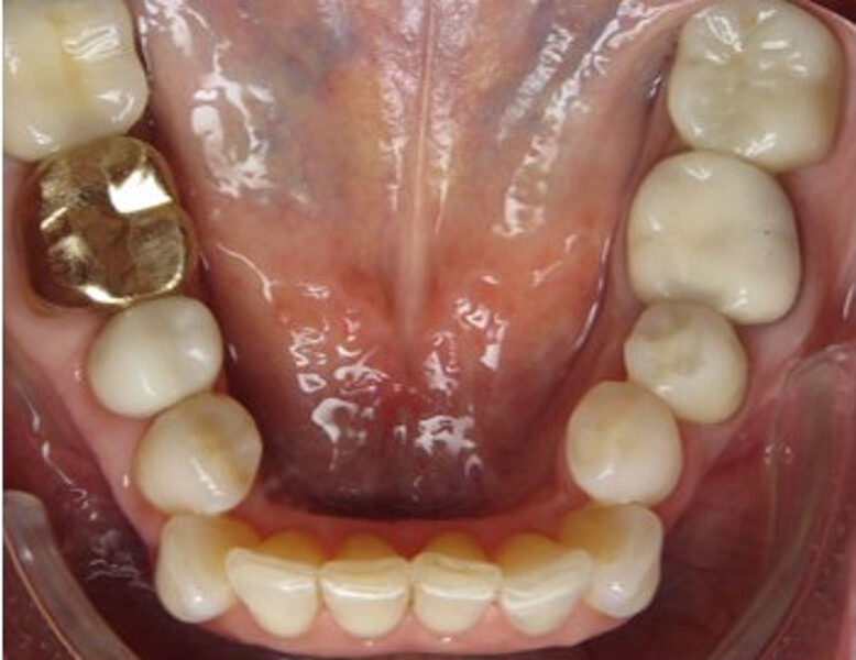 Fig. 1b