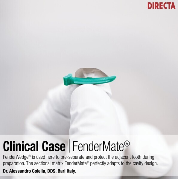 (image: Directa Dental)