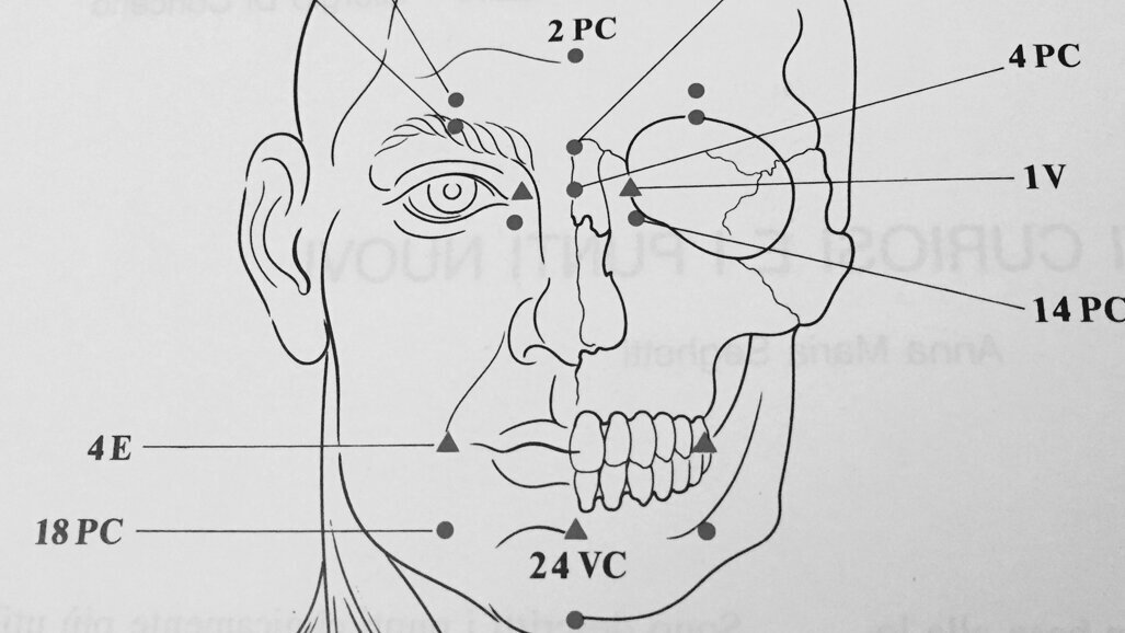 Lesione parziale del NAI: trattamento coadiuvante di un caso con agopuntura