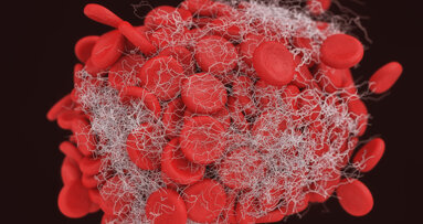 Concentrati piastrinici: Ingegneria tissutale o medicina rigenerativa?