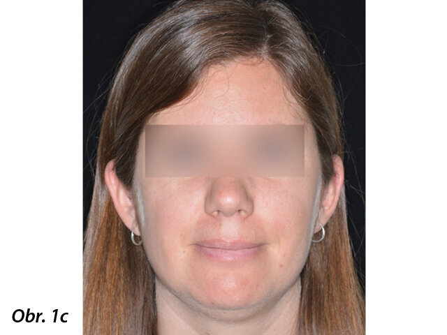 Pacientka 1 – Počáteční fotografie.