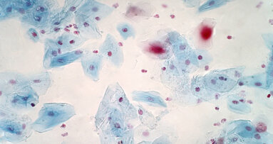 UK researchers identify bacteria capable of destroying head and neck cancer