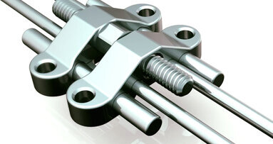 L'apparecchio Maxillary Skeletal Expander (MSE)