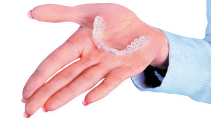 Οι διαφανείς νάρθηκες αποδεικνύονται πιο επωφελείς από τα ορθοδοντικά άγκιστρα