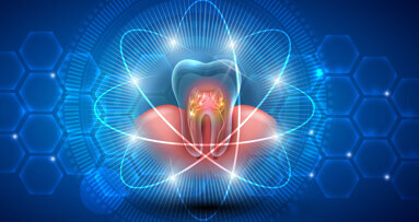 Henry Schein announces INT_ENDO campus for all endodontic needs