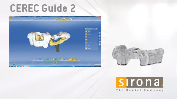 Interventi di implantologia rapidi e semplici con CEREC Guide 2