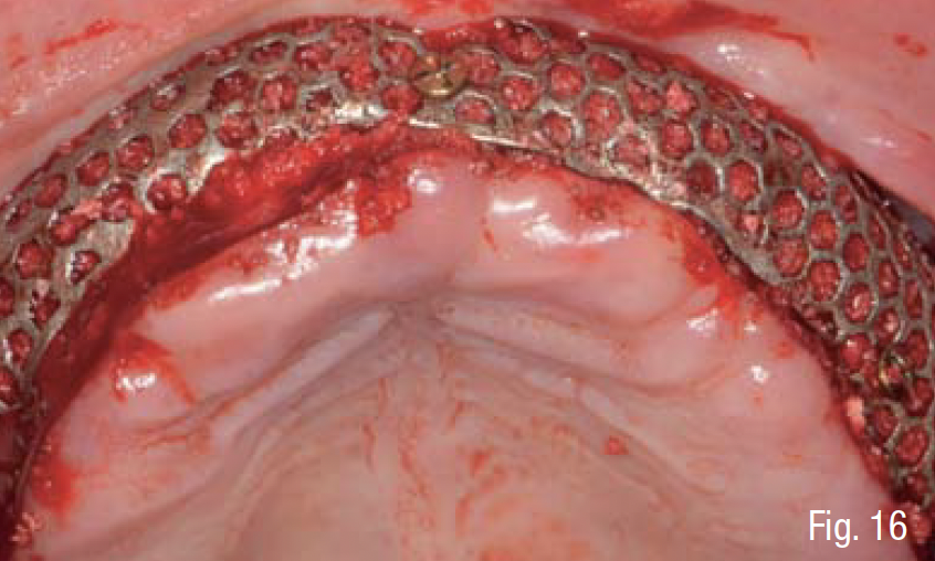 Fig. 16