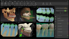DEXIS sets a new benchmark for digital dentistry with advanced AI and seamless connectivity