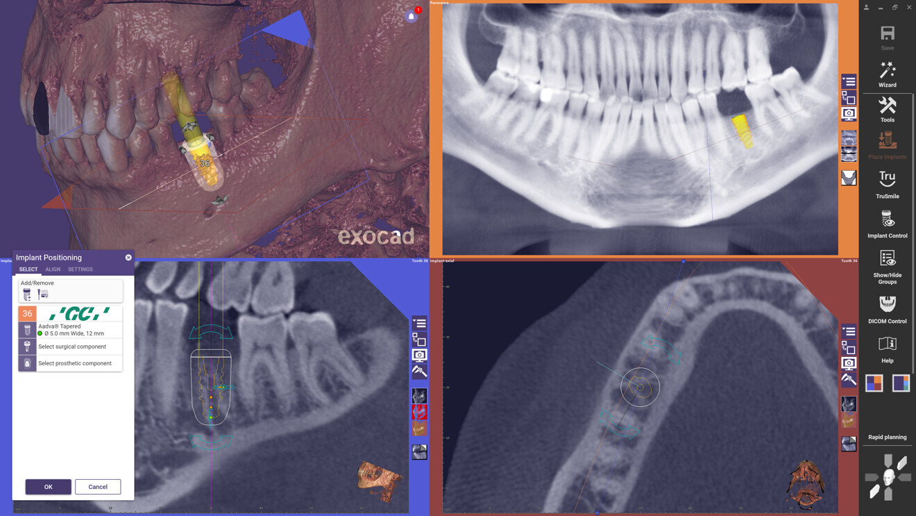 With exoplan 3.1 Rijeka, clinicians can meaningfully engage their patients in ways that support treatment acceptance. 