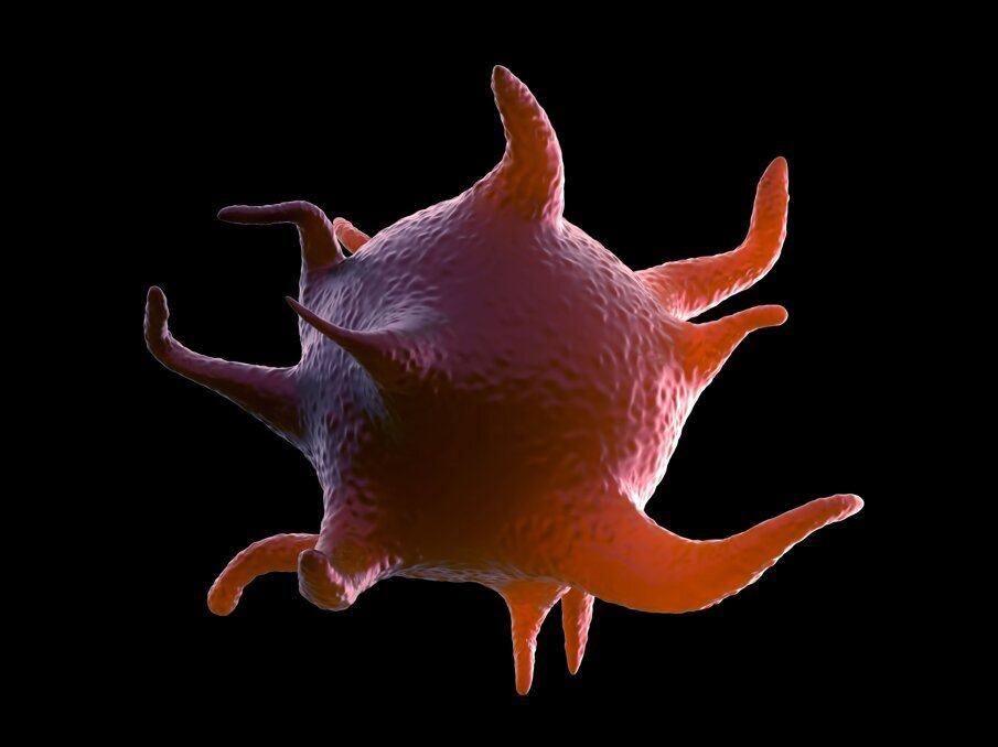 Fig. 2 - Piastrina attivata, si nota l’estroflessione di pseudopodi che permetterà la fase successiva di aggregazione.