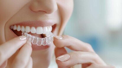 Pauschalpreise bei privaten Aligner-Shops trotz Urteil des Bundesgerichtshofs