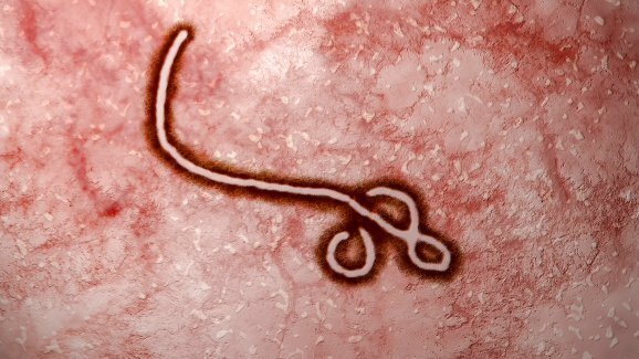 Indications des autorités sanitaires face au virus Ebola