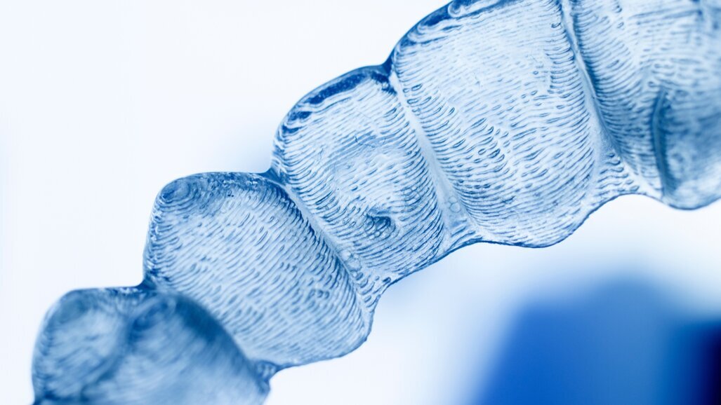 Vertical control in open bite correction using aligners and skeletal anchorage: A case series