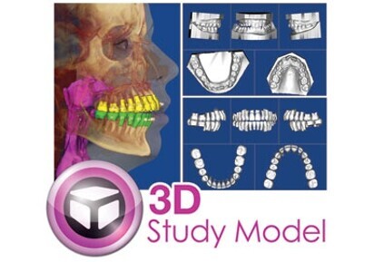 Dolphin 3D Digital Study Model software Dolphin 3D Digital Study Model software