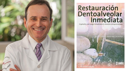 Η έξυπνη τεχνική τοποθέτησης εμφυτεύματος IDR