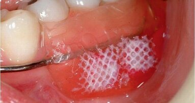 Intrinsieke suikers even schadelijk