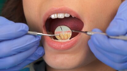 GC America to present live, biofilm-focused seminar GC America to present live, biofilm-focused seminar