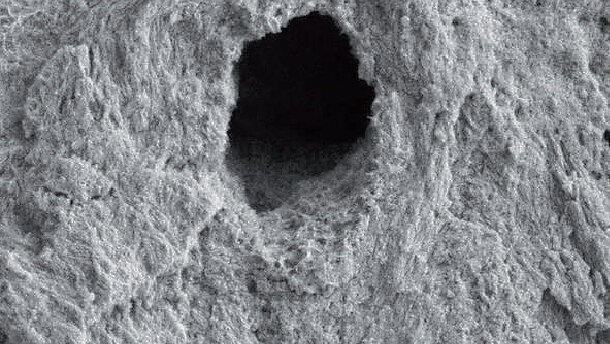 Klinické použití Er,Cr:YSGG laseru při endodontickém ošetření