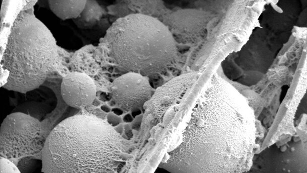 Der Klebstoff von Bakterien