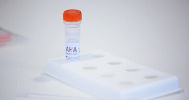 “Tijdige diagnose mondkanker redt levens”