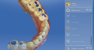 Zvýšení skusu digitálně od A do Z